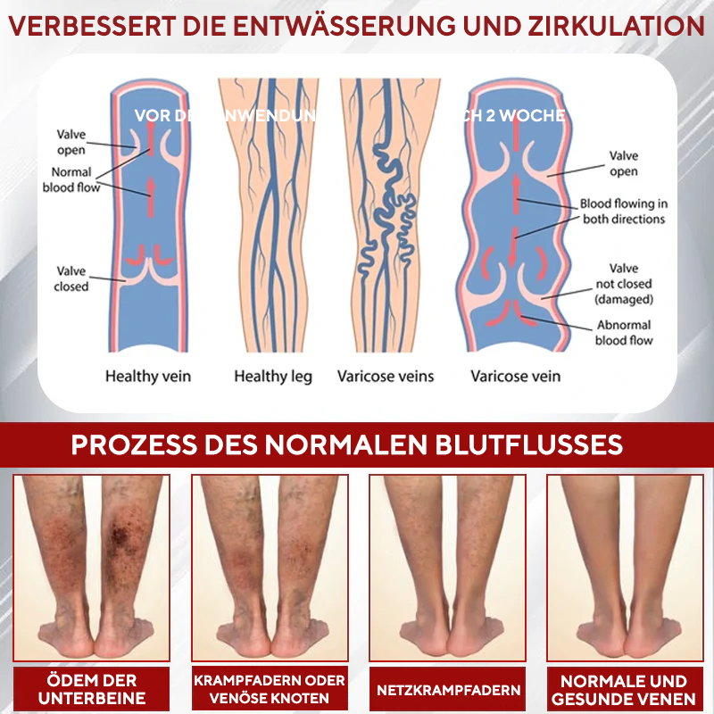 NovaRX® Rotweinstock FluidRelief Ödem-Gel