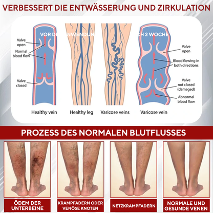 NovaRX® Rotweinstock FluidRelief Ödem-Gel