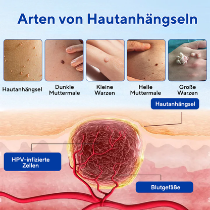 Fivfivgo® WartClear Kräutersalbe