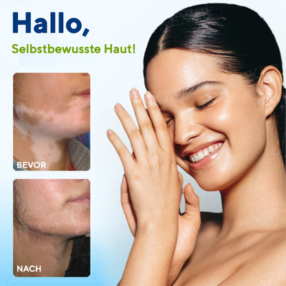 Fivfivgo® Vitiligo Behandlung Spray