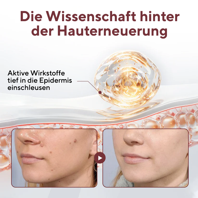 Fivfivgo® KeraErase Dual-Action Erneuerungscreme