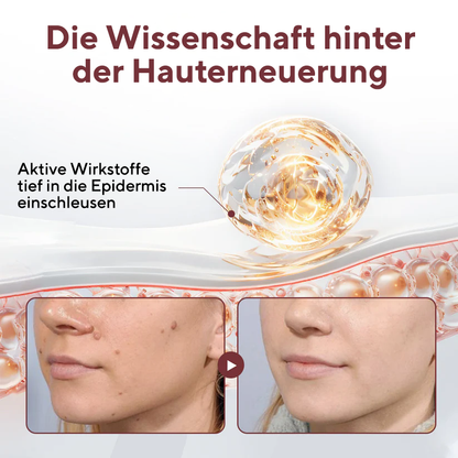 Fivfivgo® KeraErase Dual-Action Erneuerungscreme