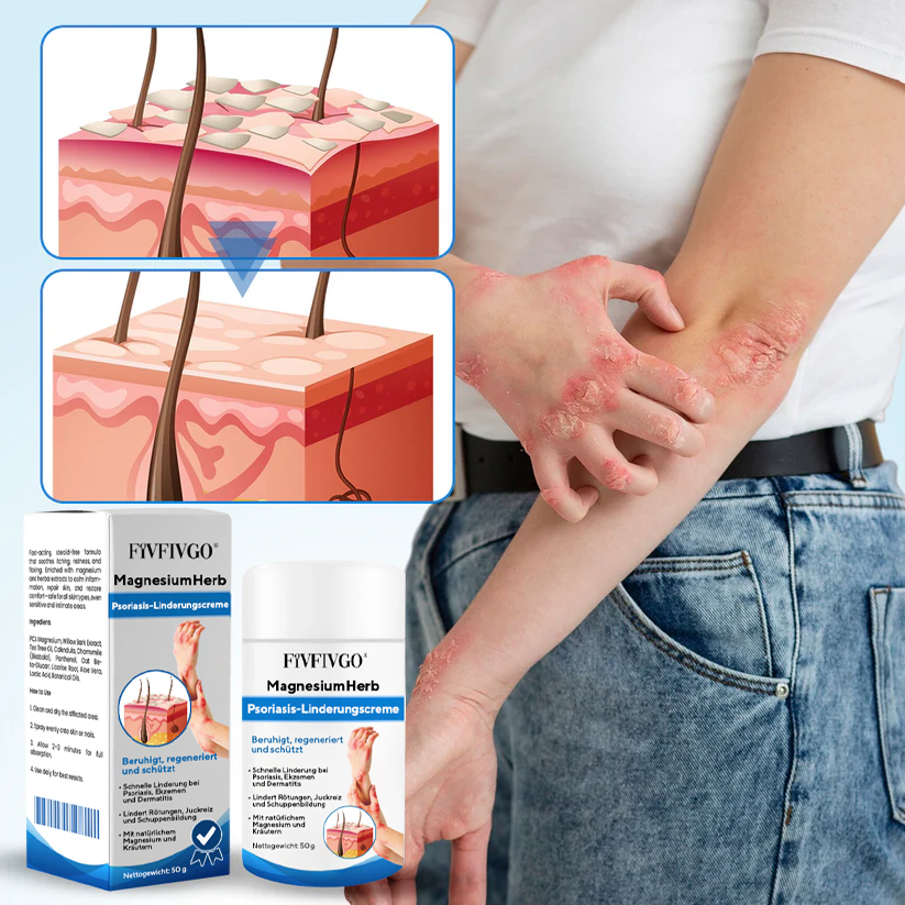 Fivfivgo® MagnesiumHerb Psoriasis-Linderungscreme