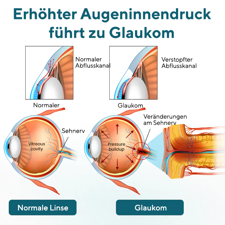 Fivfivgo® OptiRegen Nano-Augenserum 🔥 FDA-zertifiziert (klinisch erwiesen zur Wiederherstellung des Sehvermögens bei Katarakten, Presbyopie, trockenen Augen und mehr 👁️)