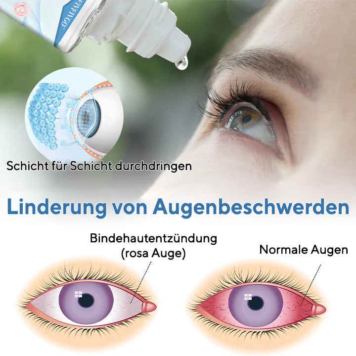Fivfivgo® ClariSee 5-in-1 Augentropfen