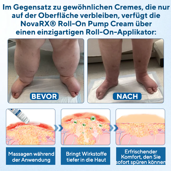 NovaRX® Lymphora Roll-on gegen Schwellungen