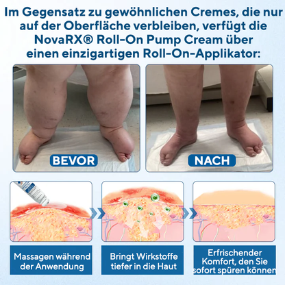NovaRX® Lymphora Roll-on gegen Schwellungen