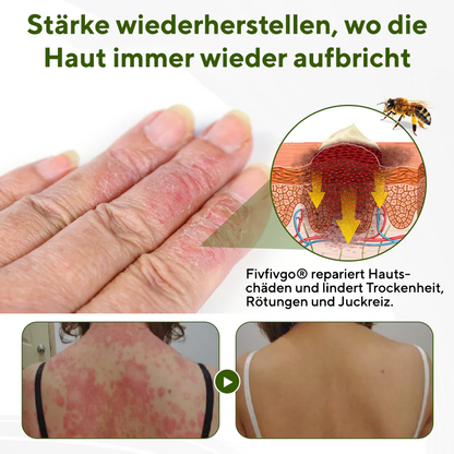 Fivfivgo® BeePeptide RootSoft DualRelief Creme