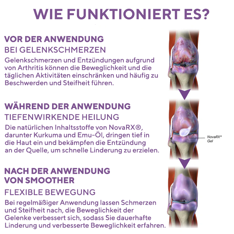 NovaRX® Gel zur Linderung von Arthritis-Schmerzen mit Kurkuma und Emu-Öl