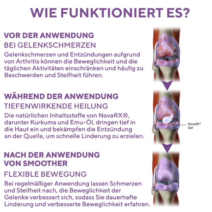 NovaRX® Gel zur Linderung von Arthritis-Schmerzen mit Kurkuma und Emu-Öl