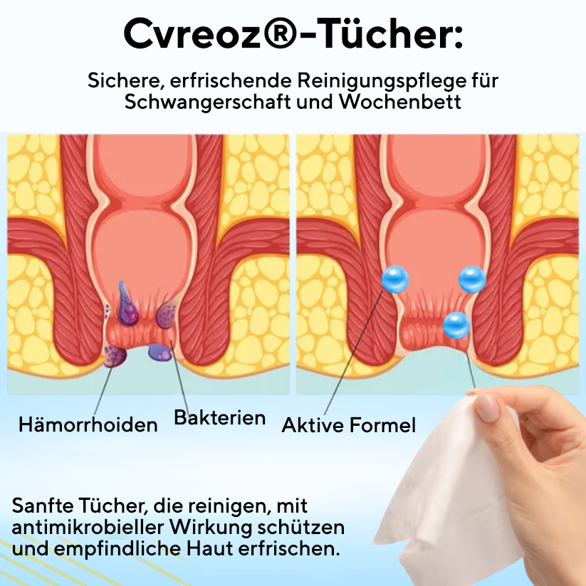 Kombinationstherapie: Cvreoz® Pflanzliches Hämorrhoiden-Behandlungsspray für den Analbereich + Reinigungstücher – Für Schwangerschaft und Wochenbett geeignet