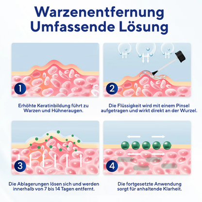 Fivfivgo® WartLift Flüssigkeit zur Entfernung von Hühneraugen