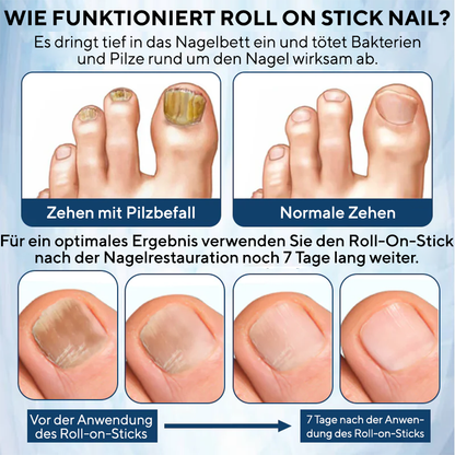 Fivfivgo® FungaGuard Botanica Roll-On-Stick