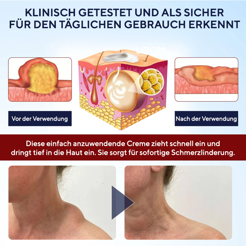 Fivfivgo®  LipoEase Kräuter-Matrix-4-Creme