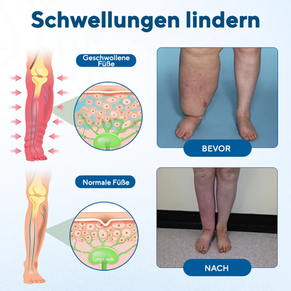 NovaRX® Lymphora Roll-on gegen Schwellungen