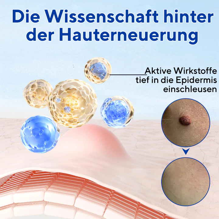 Fivfivgo® WartClear Kräutersalbe