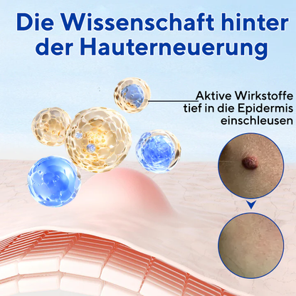 Fivfivgo® WartClear Kräutersalbe