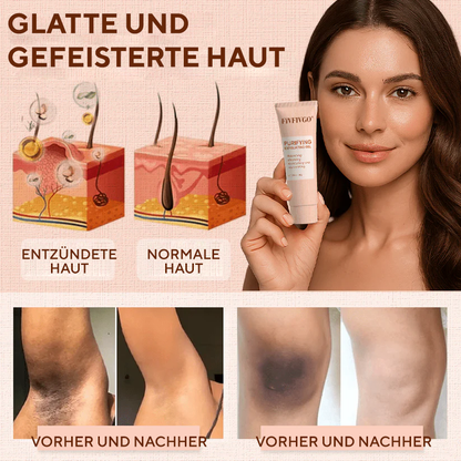 Fivfivgo® Reinigendes Peeling-Gel für Acanthosis Nigricans, Peeling, dunkle Flecken, Hautflecken und Ekzeme