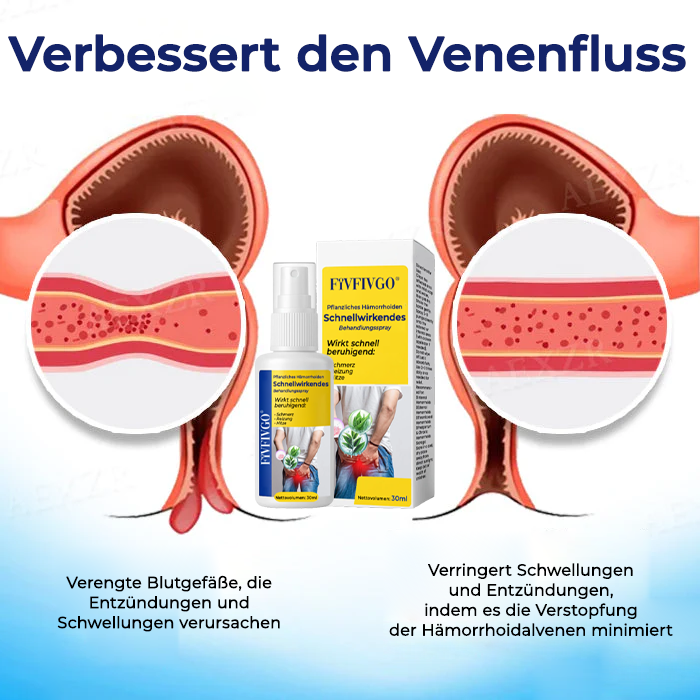 Fivfivgo® Pflanzliches Hämorrhoiden Schnellwirkendes Behandlungsspray