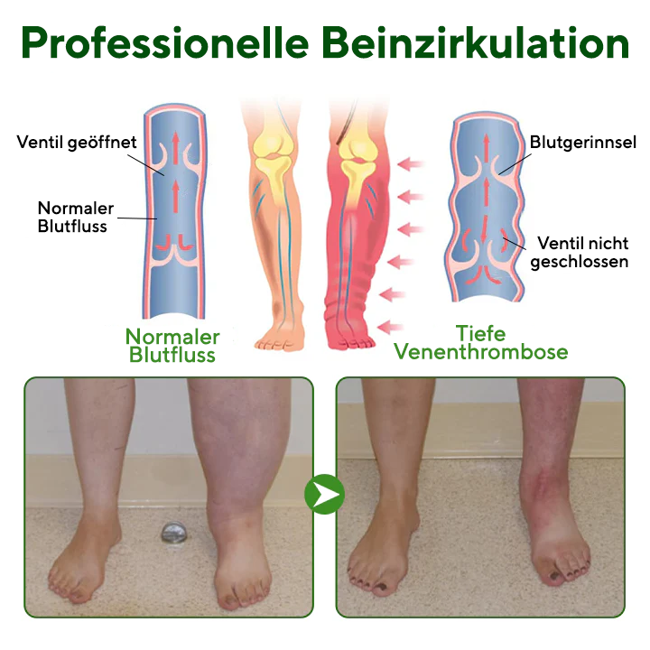 NovaRX® VenoLift Bein-Entlastungsspray