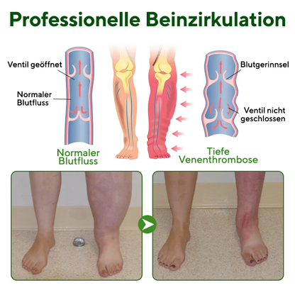 NovaRX® VenoLift Bein-Entlastungsspray