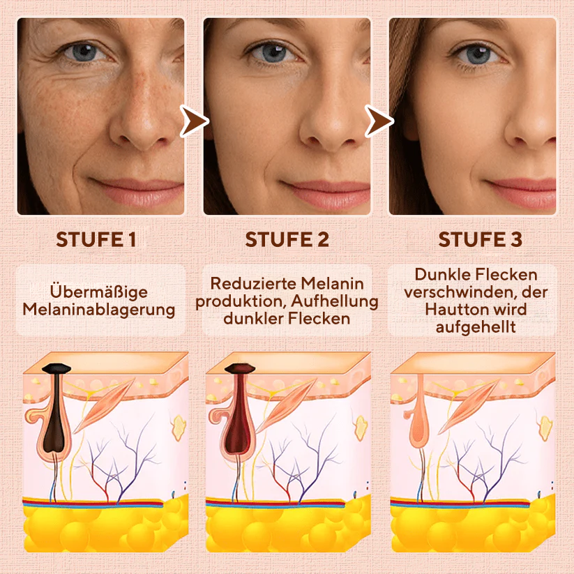 Fivfivgo® Reinigendes Peeling-Gel für Acanthosis Nigricans, Peeling, dunkle Flecken, Hautflecken und Ekzeme