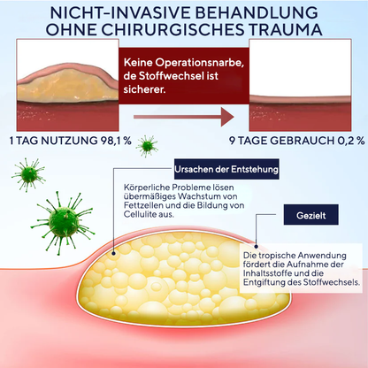 Fivfivgo®  LipoEase Kräuter-Matrix-4-Creme