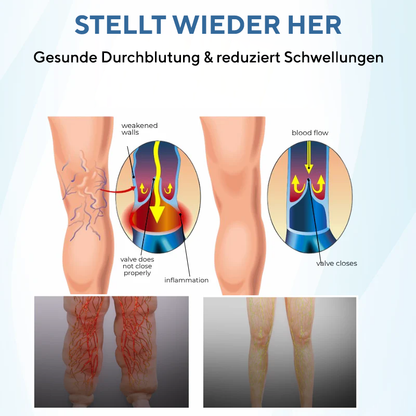 NovaRX® TheraVein Kräuterspray gegen Krampfadern