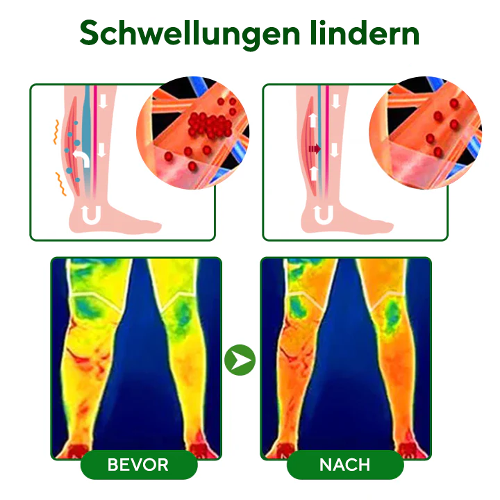 NovaRX® VenoLift Bein-Entlastungsspray