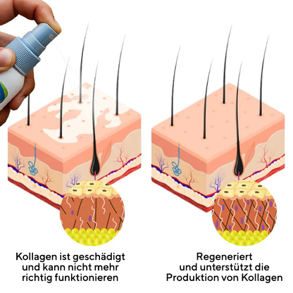 Fivfivgo® Vitiligo Behandlung Spray