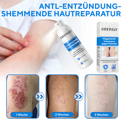 Fivfivgo® Magnesium-Kräuterspray gegen Psoriasis