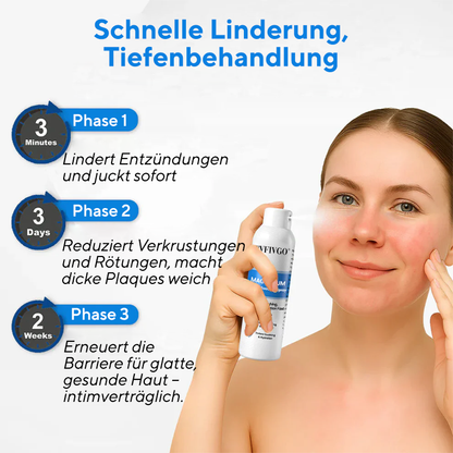 Fivfivgo® Magnesium-Kräuterspray gegen Psoriasis