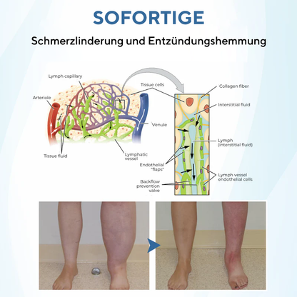 NovaRX® TheraVein Kräuterspray gegen Krampfadern