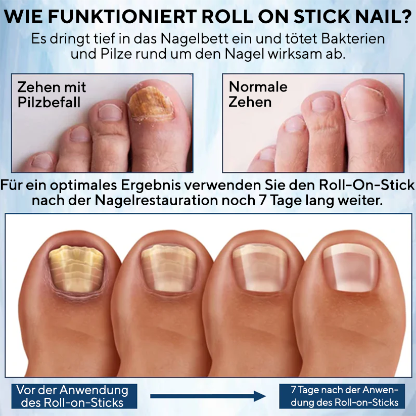 Fivfivgo® FungaGuard Botanica Roll-On-Stick