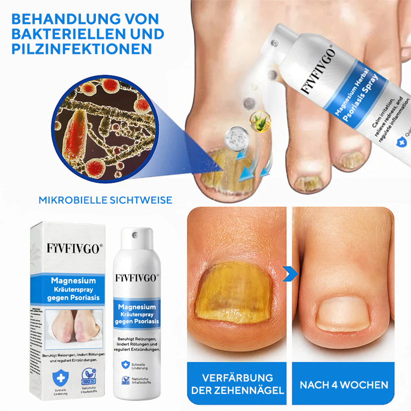 Fivfivgo® Magnesium-Kräuterspray gegen Psoriasis