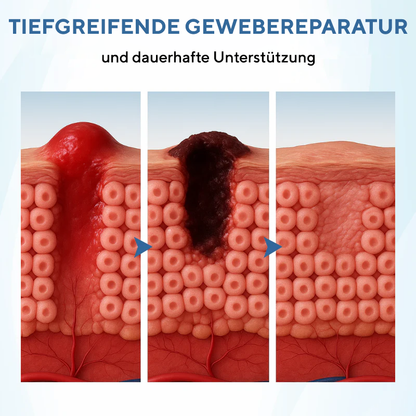 NovaRX® TheraVein Kräuterspray gegen Krampfadern