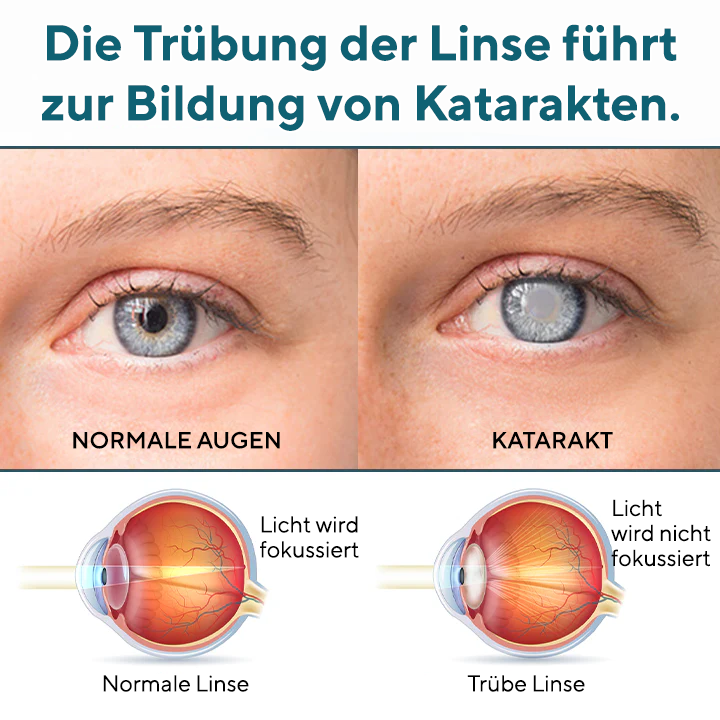 Fivfivgo® OptiRegen Nano-Augenserum 🔥 FDA-zertifiziert (klinisch erwiesen zur Wiederherstellung des Sehvermögens bei Katarakten, Presbyopie, trockenen Augen und mehr 👁️)