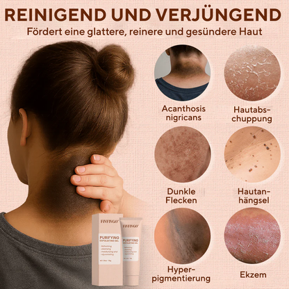 Fivfivgo® Reinigendes Peeling-Gel für Acanthosis Nigricans, Peeling, dunkle Flecken, Hautflecken und Ekzeme