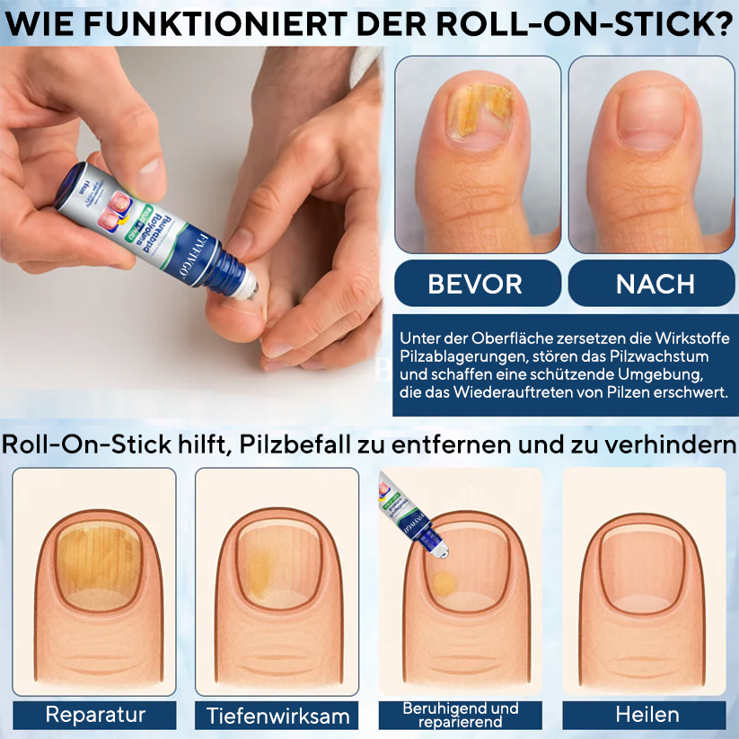Fivfivgo® FungaGuard Botanica Roll-On-Stick