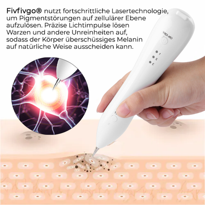 Fivfivgo® Fortschrittlicher Plasma-Laser-Punktreinigungsstift