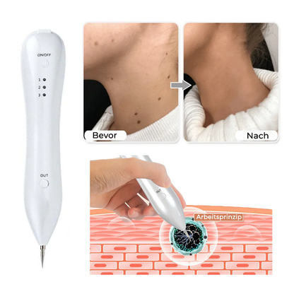 Fivfivgo® Fortschrittlicher Plasma-Laser-Punktreinigungsstift