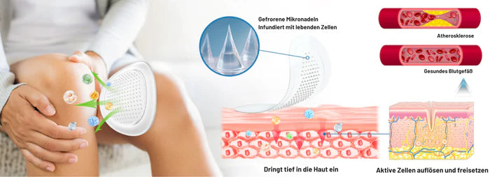 Fivfivgo® Hyaluron-Gelenkentlastung Mikronadel-Patch