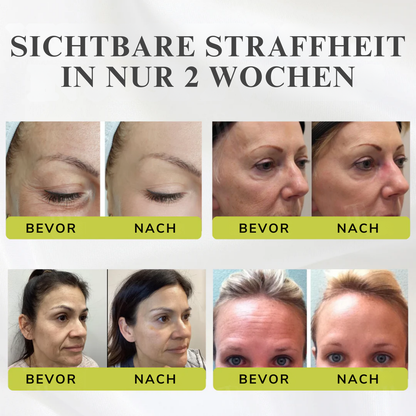 Fivfivgo® Botox & Vita-A Retinol Schuss Falten - Heben Festigende Creme