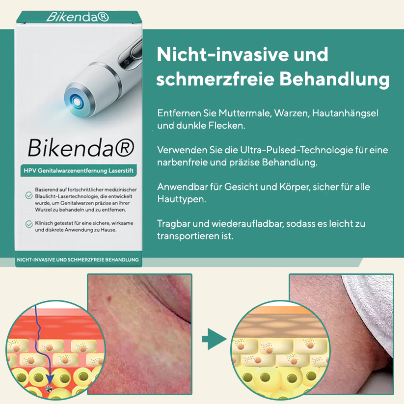 Bikenda® HPV Genitalwarzenentfernung Laserstift