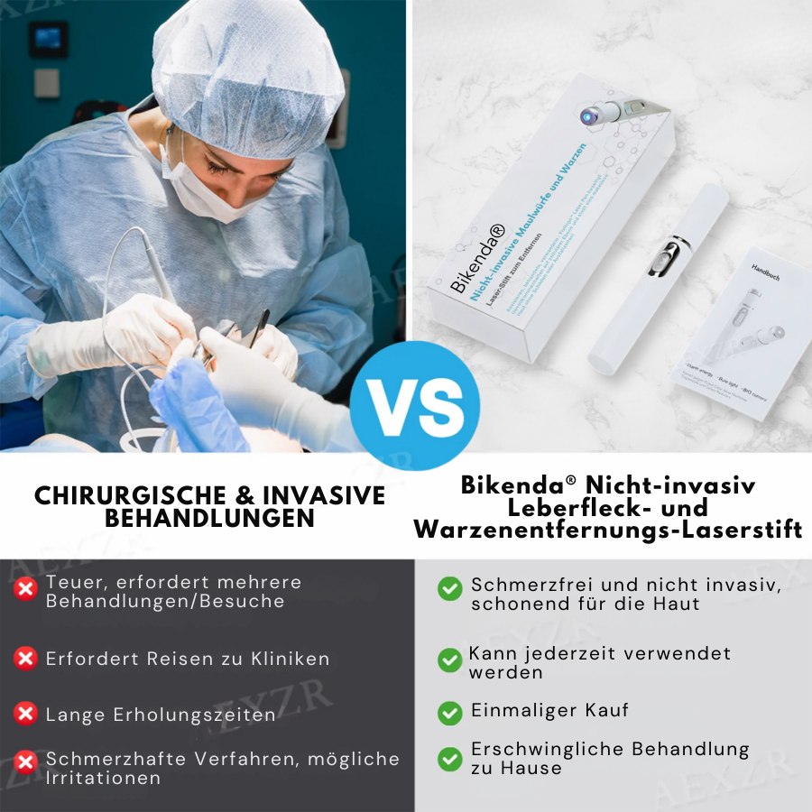 Bikenda® PRO Nicht-invasiv Leberfleck- und Warzenentfernungs-Laserstift