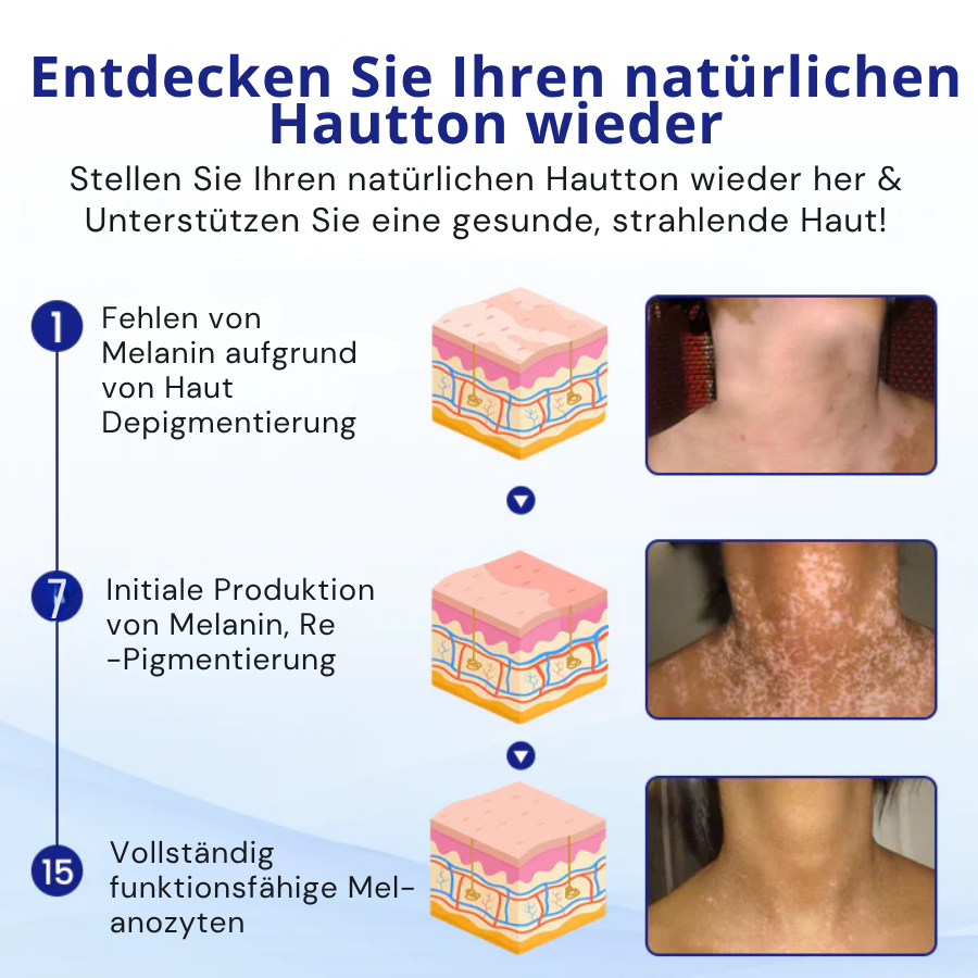 Fivfivgo® VitiClear Kräuter Spray