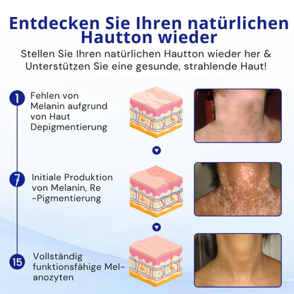 Fivfivgo® VitiClear Kräuter Spray