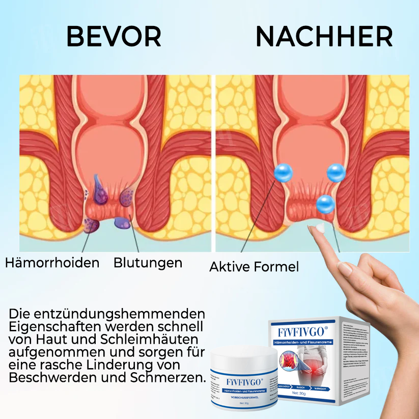 Fivfivgo® Hämorrhoiden- und Fissurencreme